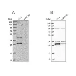 Merck Anti-PPTC7 antibody produced in rabbit