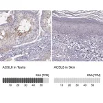Merck Anti-ACSL6 antibody produced in rabbit