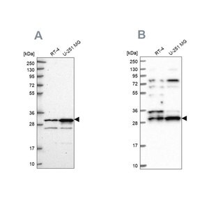 Merck Anti-HAUS1 antibody produced in rabbit