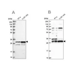Merck Anti-HAUS1 antibody produced in rabbit