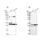 Merck Anti-HAUS1 antibody produced in rabbit