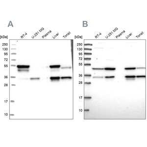 Merck Anti-CLYBL antibody produced in rabbit