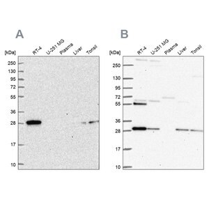 Merck Anti-PMM2 antibody produced in rabbit