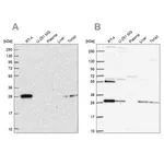 Merck Anti-PMM2 antibody produced in rabbit