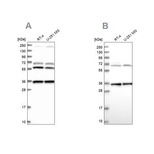 Merck Anti-DNAJC17 antibody produced in rabbit