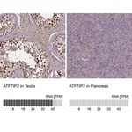 Merck Anti-ATF7IP2 antibody produced in rabbit