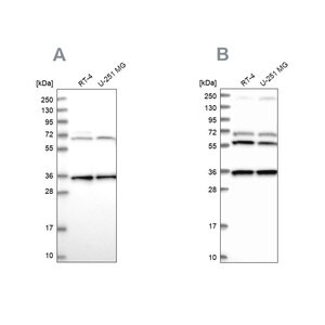 Merck Anti-DNAJC17 antibody produced in rabbit