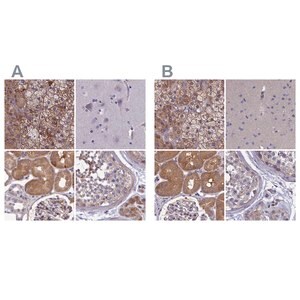 Merck Anti-AMDHD2 antibody produced in rabbit