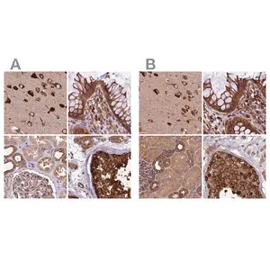 Merck Anti-KARS antibody produced in rabbit