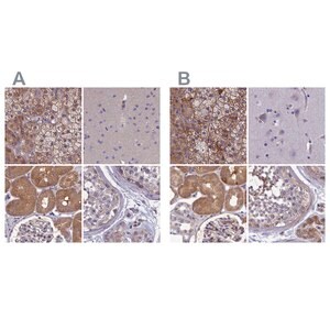Merck Anti-AMDHD2 antibody produced in rabbit