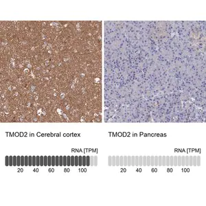 Merck Anti-TMOD2 antibody produced in rabbit