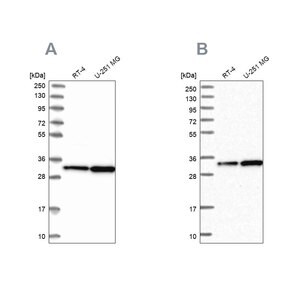 Merck Anti-TBCB antibody produced in rabbit