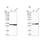 Merck Anti-TBCB antibody produced in rabbit