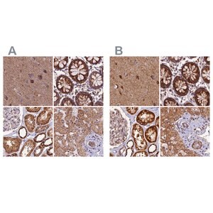 Merck Anti-NDUFA8 antibody produced in rabbit
