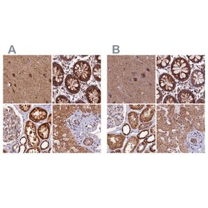 Merck Anti-NDUFA8 antibody produced in rabbit