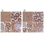 Merck Anti-NDUFA8 antibody produced in rabbit