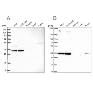 Merck Anti-NOSIP antibody produced in rabbit