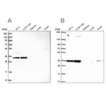 Merck Anti-NOSIP antibody produced in rabbit