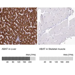 Merck Anti-ABAT antibody produced in rabbit