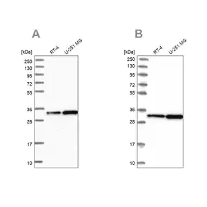 Merck Anti-TBCB antibody produced in rabbit