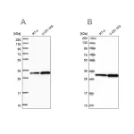 Merck Anti-TBCB antibody produced in rabbit