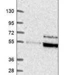 Merck Anti-DDX28 antibody produced in rabbit