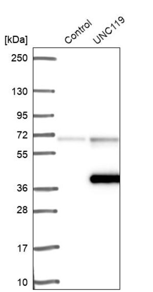 Merck Anti-UNC119 antibody produced in rabbit