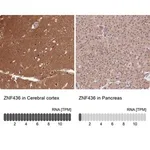 Merck Anti-ZNF436 antibody produced in rabbit