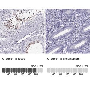 Merck Anti-C17orf64 antibody produced in rabbit