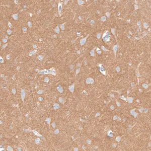 Merck Anti-IGSF21 antibody produced in rabbit