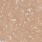 Merck Anti-IGSF21 antibody produced in rabbit