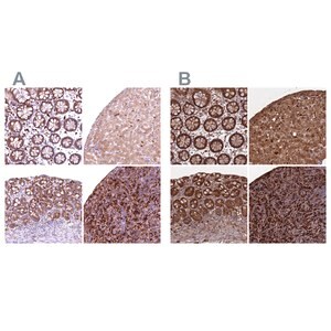 Merck Anti-BLVRB antibody produced in rabbit