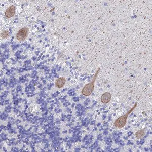 Merck Anti-KCNK18 antibody produced in rabbit
