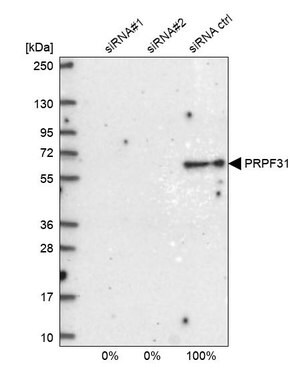 Merck Anti-PRPF31 antibody produced in rabbit