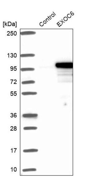 Merck Anti-EXOC6 antibody produced in rabbit