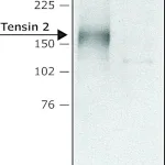Merck Anti-Tensin 2 (N-terminal) antibody produced in rabbit