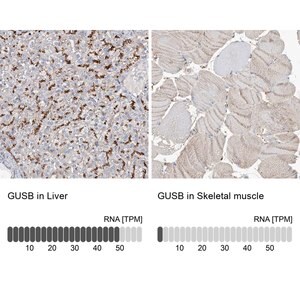 Merck Anti-GUSB antibody produced in rabbit