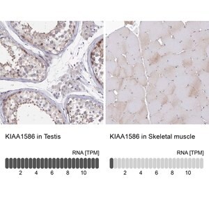 Merck Anti-KIAA1586 antibody produced in rabbit