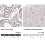 Merck Anti-KIAA1586 antibody produced in rabbit