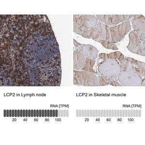 Merck Anti-LCP2 antibody produced in rabbit