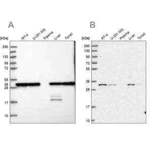 Merck Anti-PSMA1 antibody produced in rabbit