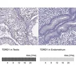 Merck Anti-TDRD1 antibody produced in rabbit