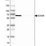 Merck Anti-ACAD9 antibody produced in rabbit