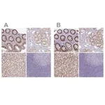 Merck Anti-A1CF antibody produced in rabbit