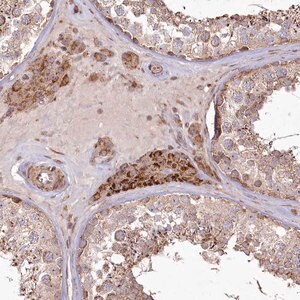 Merck Anti-PSTK antibody produced in rabbit