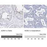 Merck Anti-ACRV1 antibody produced in rabbit