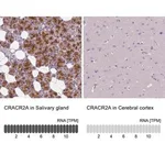 Merck Anti-CRACR2A antibody produced in rabbit
