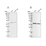 Merck Anti-PSMD13 antibody produced in rabbit