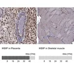 Merck Anti-IKBIP antibody produced in rabbit