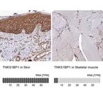 Merck Anti-TNKS1BP1 antibody produced in rabbit
